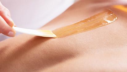 Epilation au laser, lumière pulsée, Levallois-Perret Epilation au laser, lumière pulsée, Levallois-Perret